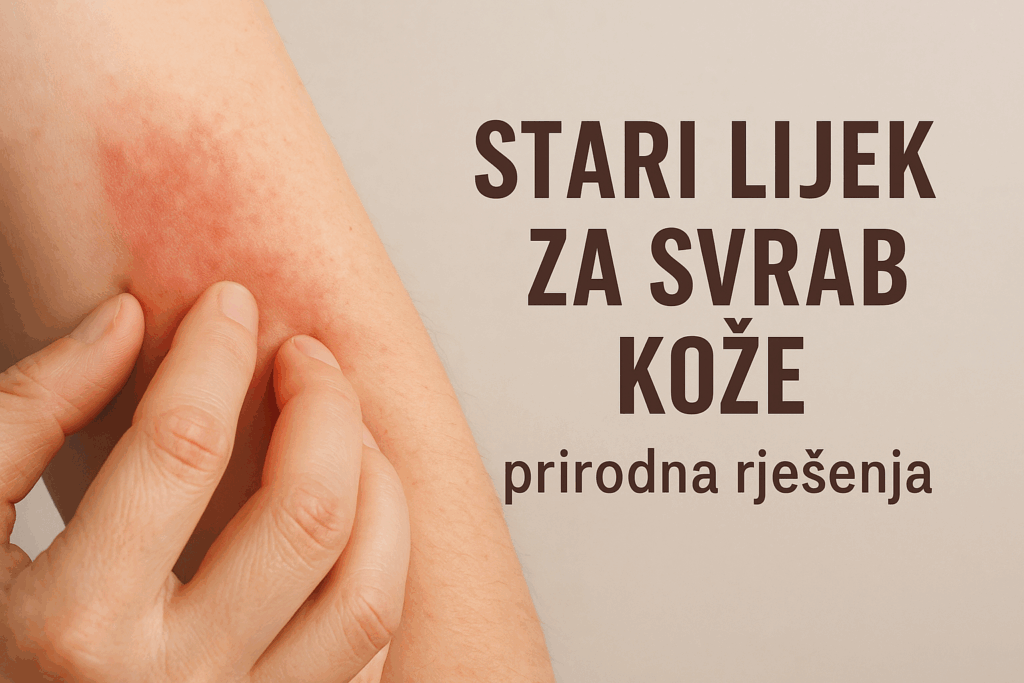Stari lijek za svrab kože - prirodna rješenja koja djeluju