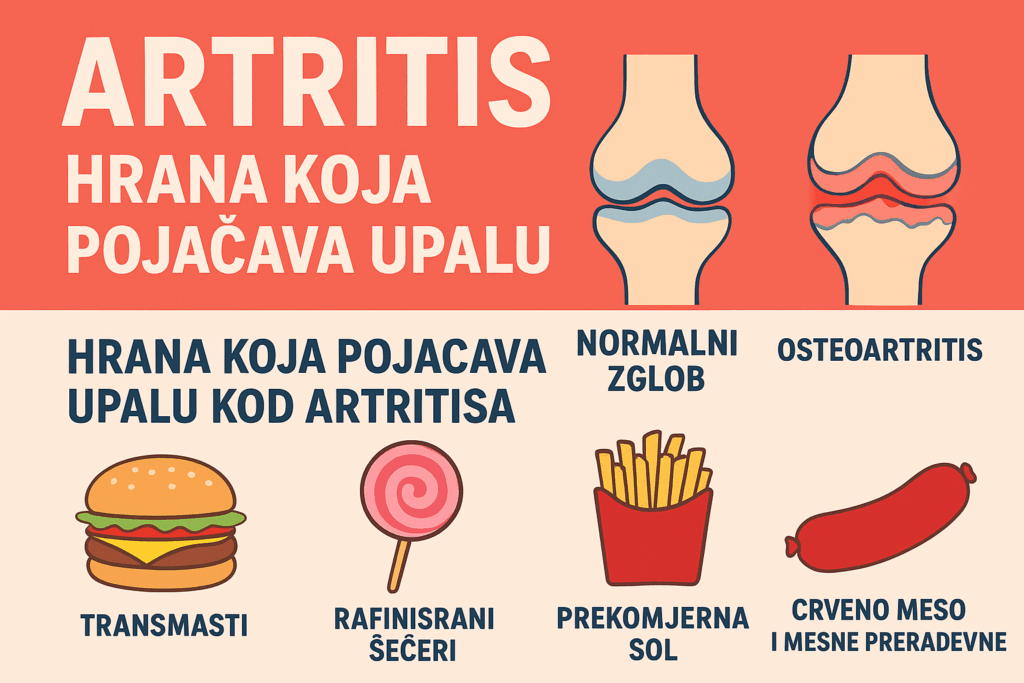 Zabranjena hrana kod artritisa namirnice koje izazivaju upalu